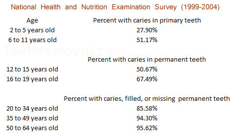 National Health and Nutrition Examination Survey dental caries