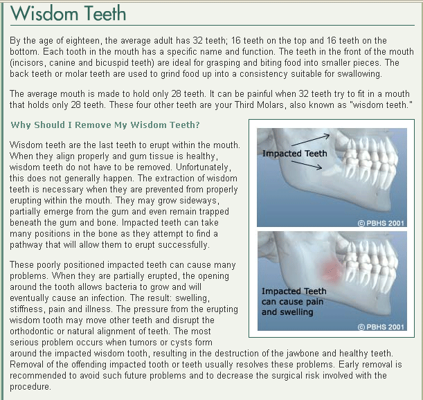 Impacted Wisdom Teeth Impacted Wisdom Teeth