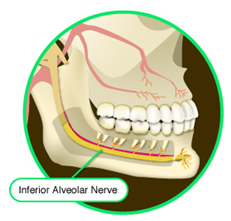 Lingual Nerve