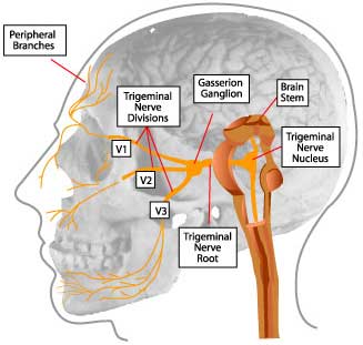 trigemenial nerve