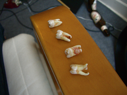 wisdom teeth on table