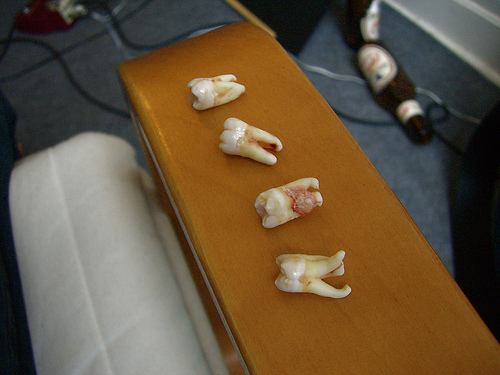 wisdom teeth on table