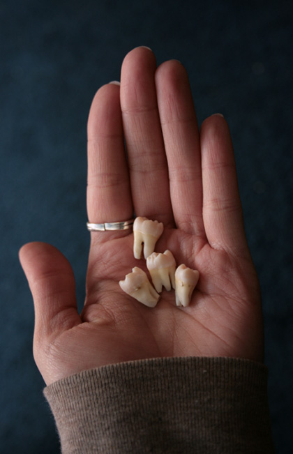 four wisdom teeth in womens hand