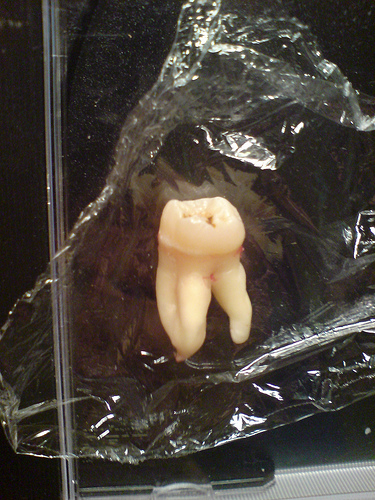 wisdom tooth bag